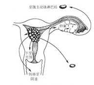 子宫内膜癌